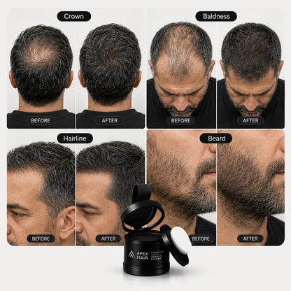Before and after views of crown, hairline and beard areas covered with APEX HAIR powder.